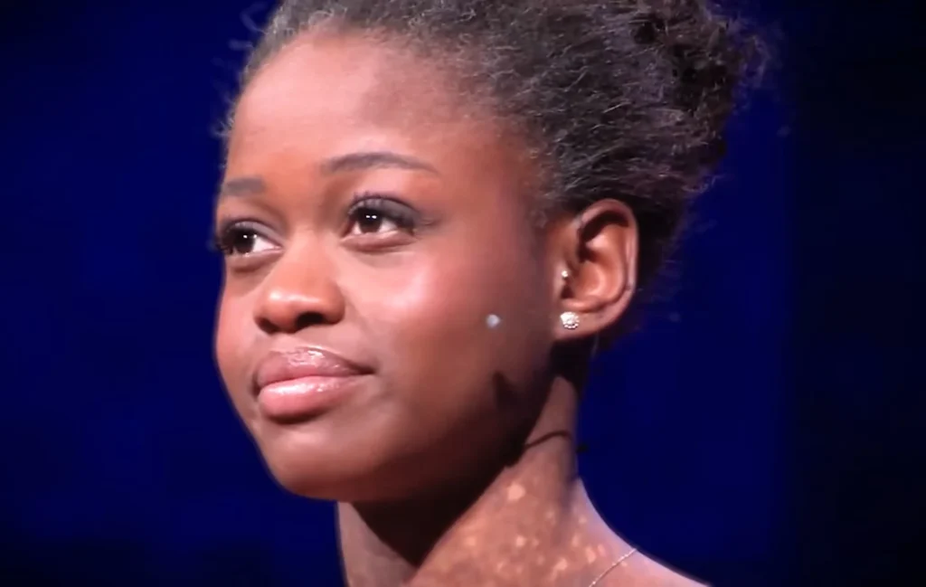 Michaela DePrince Todesursache